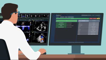 EchoSolv Screenshot for Vimeo animation video